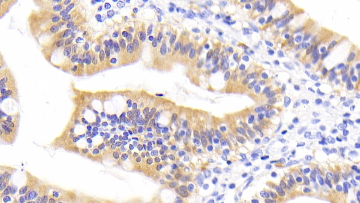 Immunohistochemistry-Paraffin RBP2 Antibody (D2)