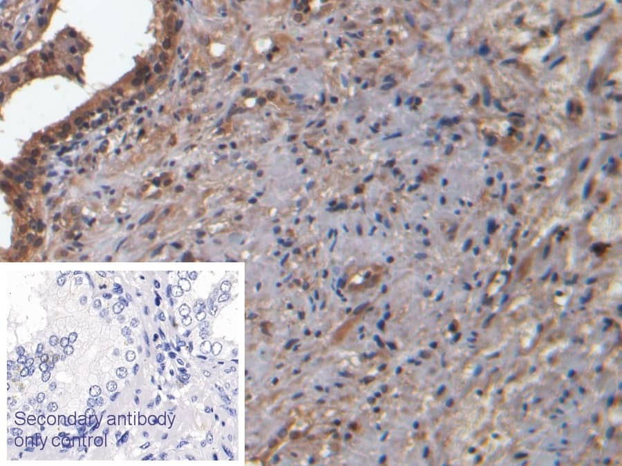 Immunohistochemistry-Paraffin: Muscarinic Acetylcholine Receptor M3/CHRM3 Antibody (C1) [NBP3-41117] - DAB staining on IHC-P; Sample: Human Prostate Tissue; Primary Ab: 20ug/ml NBP3-41117; Second Ab: 2ug/mL HRP-Linked Caprine Anti-Mouse IgG Polyclonal Antibody