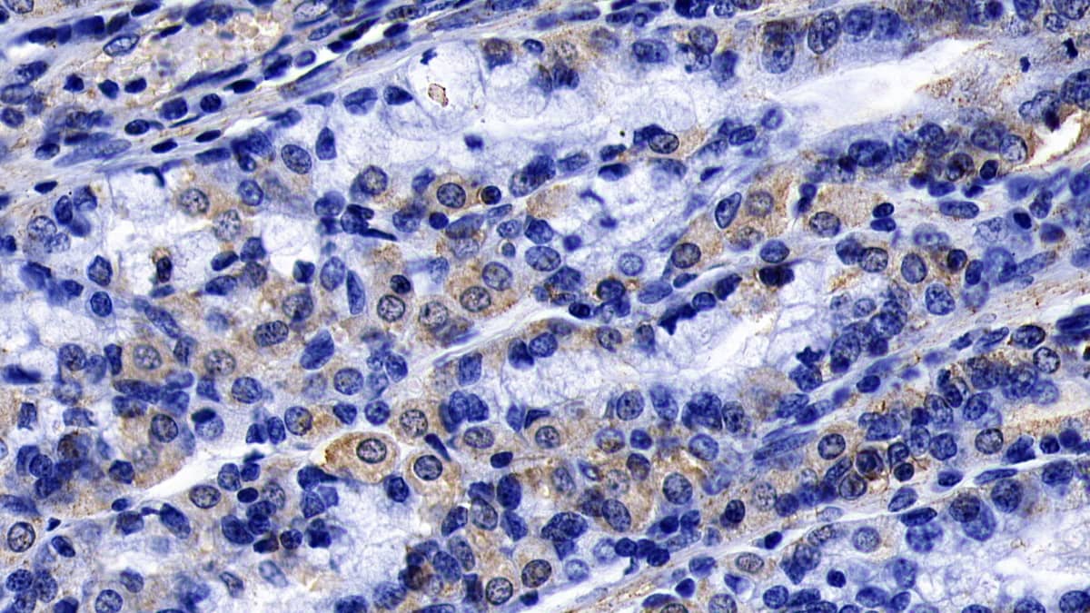 Immunohistochemistry-Paraffin: FGF-9 Antibody (E4) [NBP3-41128] - DAB staining on IHC-P; Sample: Human Stomach Tissue; Primary Ab: 20ug/ml NBP3-41128; Second Ab: 2ug/mL HRP-Linked Caprine Anti-Mouse IgG Polyclonal Antibody