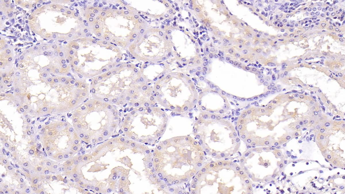 Immunohistochemistry-Paraffin: NT-3 Antibody (C3) [NBP3-41129] - DAB staining on IHC-P; Samples: Human Kidney Tissue; Primary Ab: 40ug/ml NBP3-41129; Second Ab: 2ug/mL HRP-Linked Caprine Anti-Mouse IgG Polyclonal Antibody