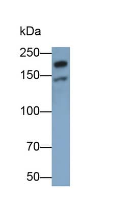 Western Blot: Laminin beta 1 Antibody (C1) [NBP3-41130] - Sample: 3T3-L1 cell lysate Primary Ab: 0.2ug/ml NBP3-41130; Second Ab: 0.2ug/mL HRP-Linked Caprine Anti-Mouse IgG Polyclonal Antibody