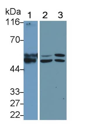 Western Blot: MMP-11 Antibody (5#) [NBP3-41131] - Sample: Lane1: Human Placenta lysate; Lane2: T-47D cell lysate; Lane3: Hela cell lysate Primary Ab: 1ug/ml NBP3-41131; Second Ab: 0.2ug/mL HRP-Linked Caprine Anti-Mouse IgG Polyclonal Antibody