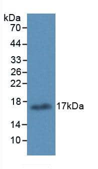 Western Blot: 15-Lipoxygenase 1 Antibody (6#) [NBP3-41135] - Sample: Recombinant 15-Lipoxygenase 1, Human.