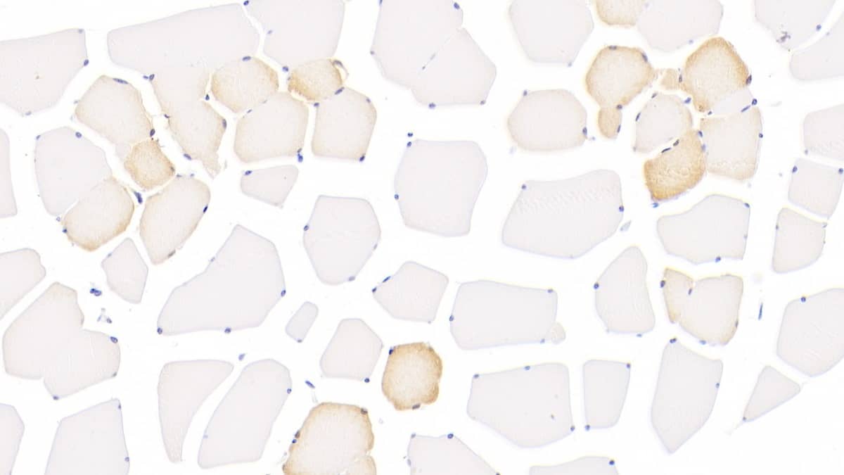 Immunohistochemistry-Paraffin: 15-Lipoxygenase 1 Antibody (6#) [NBP3-41135] - DAB staining on IHC-P; Samples: Human Skeletal muscle Tissue; Primary Ab: 30ug/ml NBP3-41135; Second Ab: 2ug/mL HRP-Linked Caprine Anti-Mouse IgG Polyclonal Antibody