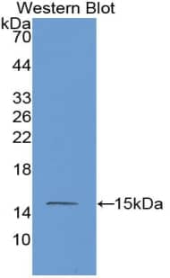 Western Blot: MASP2 Antibody (C9) [NBP3-41136] - Sample: Recombinant MASP2, Human.