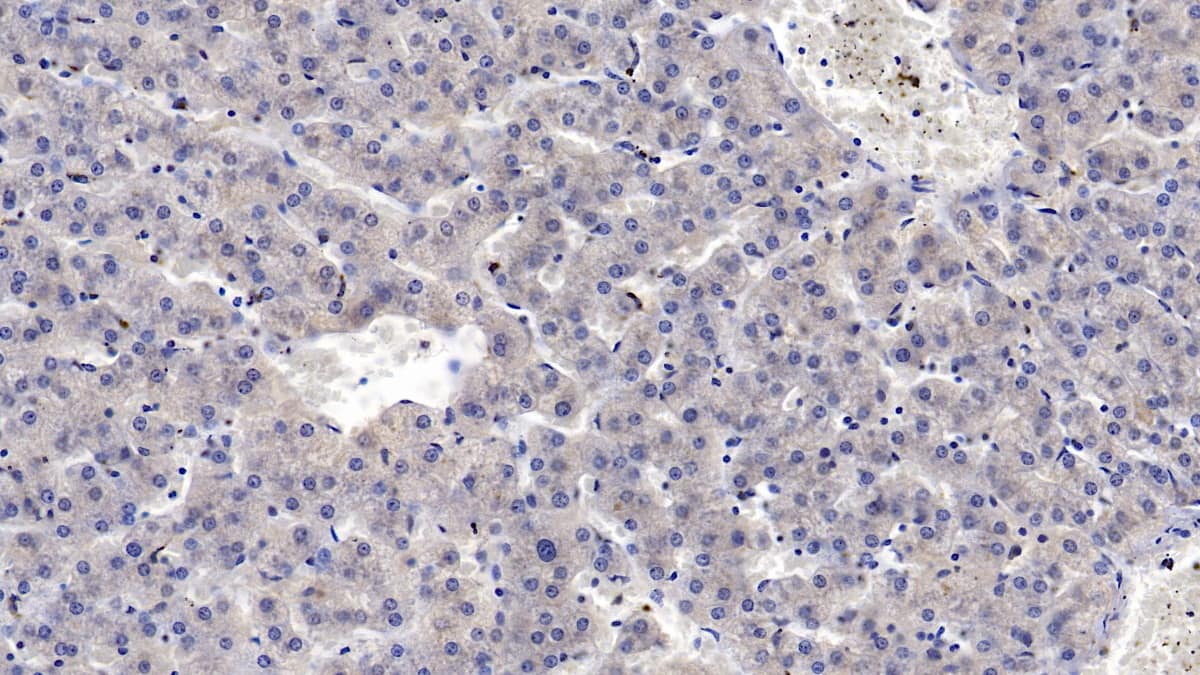 Immunohistochemistry-Paraffin: MASP2 Antibody (C9) [NBP3-41136] - DAB staining on IHC-P; Samples: Human Liver Tissue; Primary Ab: 10ug/ml NBP3-41136; Second Ab: 2ug/mL HRP-Linked Caprine Anti-Mouse IgG Polyclonal Antibody