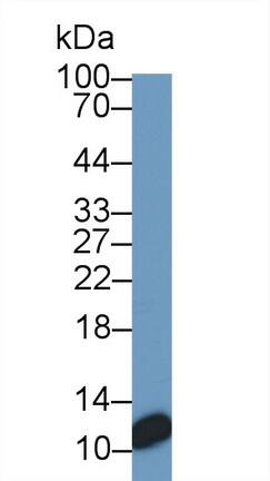 Western Blot: S100A/B Antibody (C8) [NBP3-41140] - Sample: Lane1: HT1080 cell lysate; Lane2: HepG2 cell lysate