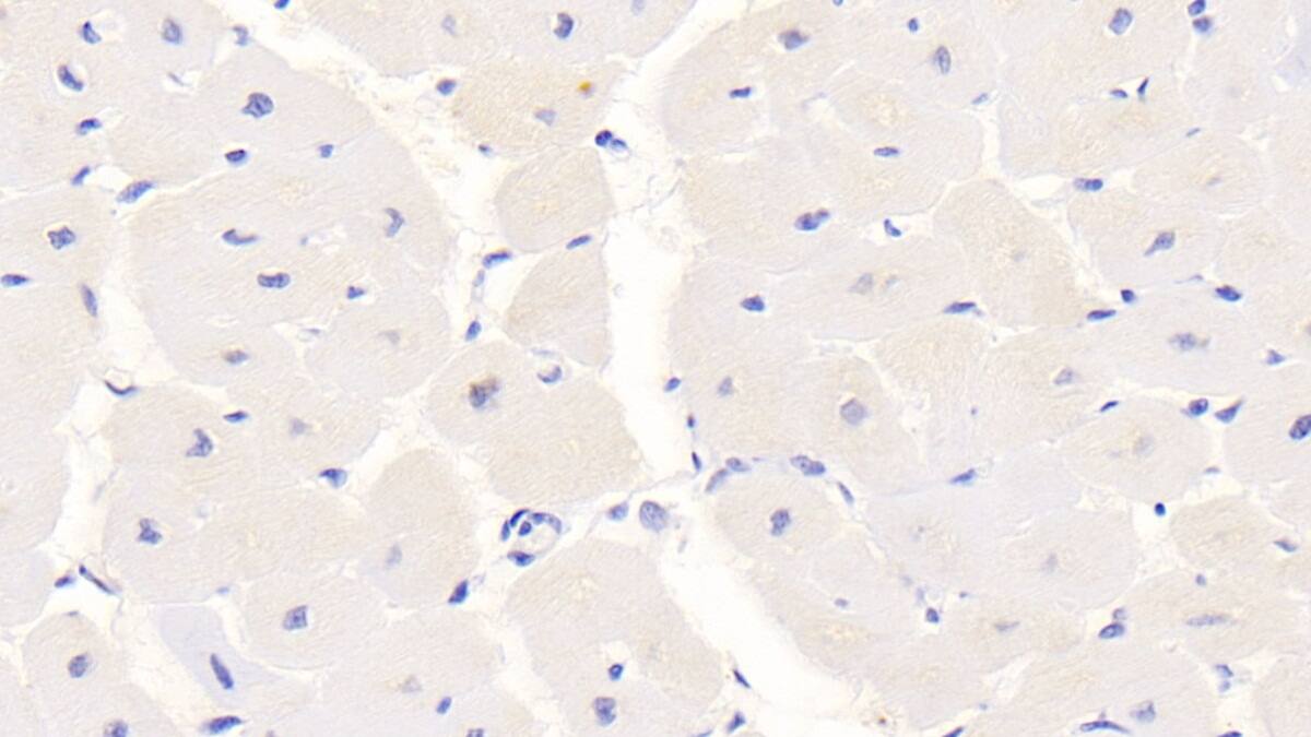 Immunohistochemistry-Paraffin: S100A/B Antibody (C8) [NBP3-41140] - DAB staining on IHC-P; Samples: Human Cardiac Muscle Tissue; Primary Ab: 30ug/ml NBP3-41140; Second Ab: 2ug/mL HRP-Linked Caprine Anti-Mouse IgG Polyclonal Antibody