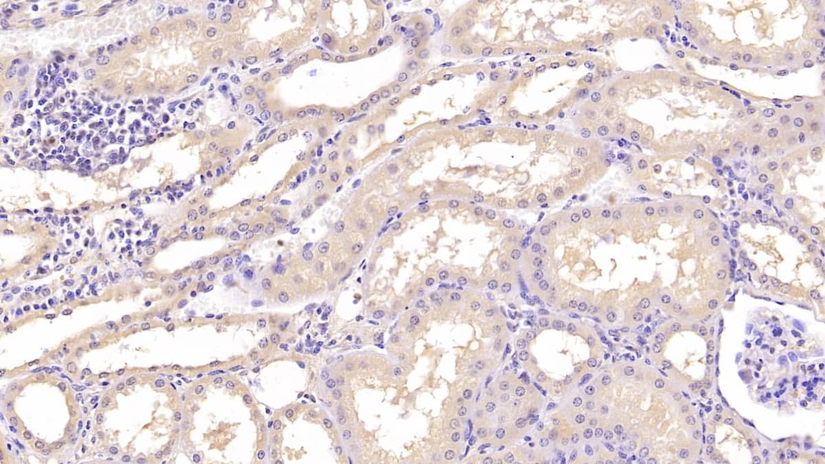 Immunohistochemistry-Paraffin: Annexin V Antibody (C13) [NBP3-41141] - DAB staining on IHC-P;  Sample: Human Kidney Tissue; Primary Ab: 40ug/ml NBP3-41141; Second Ab: 2ug/mL HRP-Linked Caprine Anti-Mouse IgG Polyclonal Antibody;