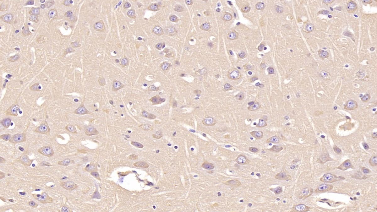 Immunohistochemistry-Paraffin: Annexin V Antibody (C13) [NBP3-41141] - DAB staining on IHC-P;  Sample: Human Cerebrum Tissue; Primary Ab: 40ug/ml NBP3-41141; Second Ab: 2ug/mL HRP-Linked Caprine Anti-Mouse IgG Polyclonal Antibody;