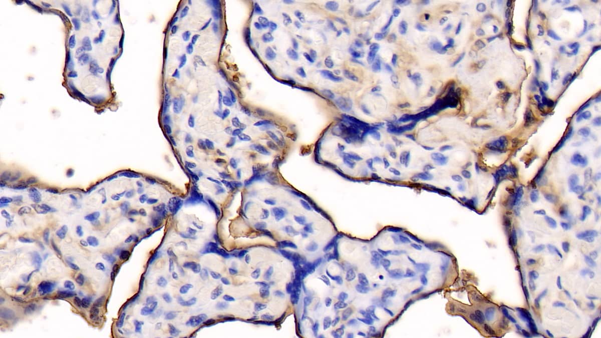 Immunohistochemistry-Paraffin: Annexin V Antibody (C10-1) [NBP3-41142] - DAB staining on IHC-P; Samples: Human Placenta Tissue; Primary Ab: 20ug/ml NBP3-41142; Second Ab: 2ug/mL HRP-Linked Caprine Anti-Mouse IgG Polyclonal Antibody