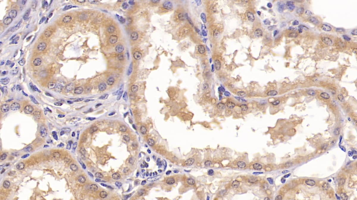 Immunohistochemistry-Paraffin: Annexin V Antibody (C10-1) [NBP3-41142] - DAB staining on IHC-P; Samples: Human Colon Tissue; Primary Ab: 20ug/ml NBP3-41142; Second Ab: 2ug/mL HRP-Linked Caprine Anti-Mouse IgG Polyclonal Antibody