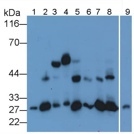 Western Blot: Cathepsin K Antibody (C1) [NBP3-41143] - Sample: Lane1: Human Cartilage lysate; Lane2: Porcine Cartilage lysate; Lane3: Rat Ear lysate; Lane4: Mouse Cartilage lysate; Lane5: Canine Cartilage lysate; Lane6: Bovine Cartilage lysate; Lane7: Caprine Cartilage lysate; Lane8: Rabbit Uterus lysate; Lane9: Equine Lung lysate Primary Ab: 0.02ug/ml NBP3-41143; Second Ab: 0.2ug/mL HRP-Linked Caprine Anti-Mouse IgG Polyclonal Antibody