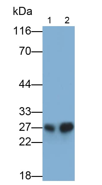 Western Blot: Cathepsin K Antibody (C1) [NBP3-41143] - Sample: Rat Skeletal muscle lysate; Primary Ab: 3ug/ml NBP3-41143; Second Ab: 0.2ug/mL HRP-Linked Caprine Anti-Mouse IgG Polyclonal Antibody