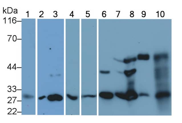 Western Blot: Cathepsin K Antibody (C1) [NBP3-41143] - Sample: Lane1: Human Lung lysate; Lane2: Porcine Heart lysate; Lane3: Porcine Uterus lysate; Lane4: Human Cartilage lysate; Lane5: Human Lung lysate; Lane6: Porcine Cartilage lysate; Lane7: Rat Ear lysate; Lane8: Rat Uterus lysate; Lane9: Mouse Cartilage lysate; Lane10: Mouse Uterus lysate Primary Ab: 0.2ug/ml NBP3-41143; Second Ab: 0.2ug/mL HRP-Linked Caprine Anti-Mouse IgG Polyclonal Antibody