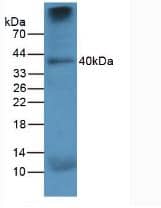 Western Blot: Cathepsin K Antibody (C4) [NBP3-41144] - Sample: Human Lung Tissue.