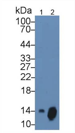 Western Blot: CXCL7/NAP-2 Antibody (15#) [NBP3-41148] - Sample: Lane1: Human Serum; Lane2: Human Leukocyte cell lysate Primary Ab: 3ug/ml NBP3-41148; Second Ab: 0.2ug/mL HRP-Linked Caprine Anti-Mouse IgG Polyclonal Antibody