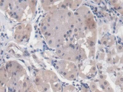 Immunohistochemistry-Paraffin: EGR1 Antibody (C11) [NBP3-41149] - DAB staining on IHC-P; Samples: Human Stomach Tissue; Primary Ab: 20ug/ml NBP3-41149; Second Ab: 2ug/mL HRP-Linked Caprine Anti-Mouse IgG Polyclonal Antibody