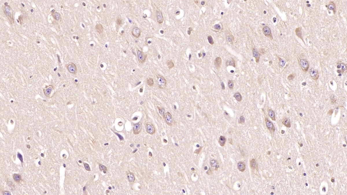 Immunohistochemistry-Paraffin: MOG Antibody (C1) [NBP3-41150] - DAB staining on IHC-P; Samples: Human Cerebrum Tissue; Primary Ab: 40ug/ml NBP3-41150; Second Ab: 2ug/mL HRP-Linked Caprine Anti-Mouse IgG Polyclonal Antibody