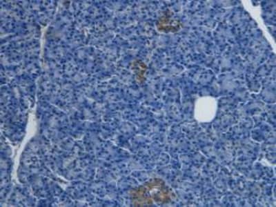 Immunohistochemistry-Paraffin: Endothelin-1 Antibody (C3) [NBP3-41152] - DAB staining on IHC-P; Samples: Human Pancreas Cancer Tissue