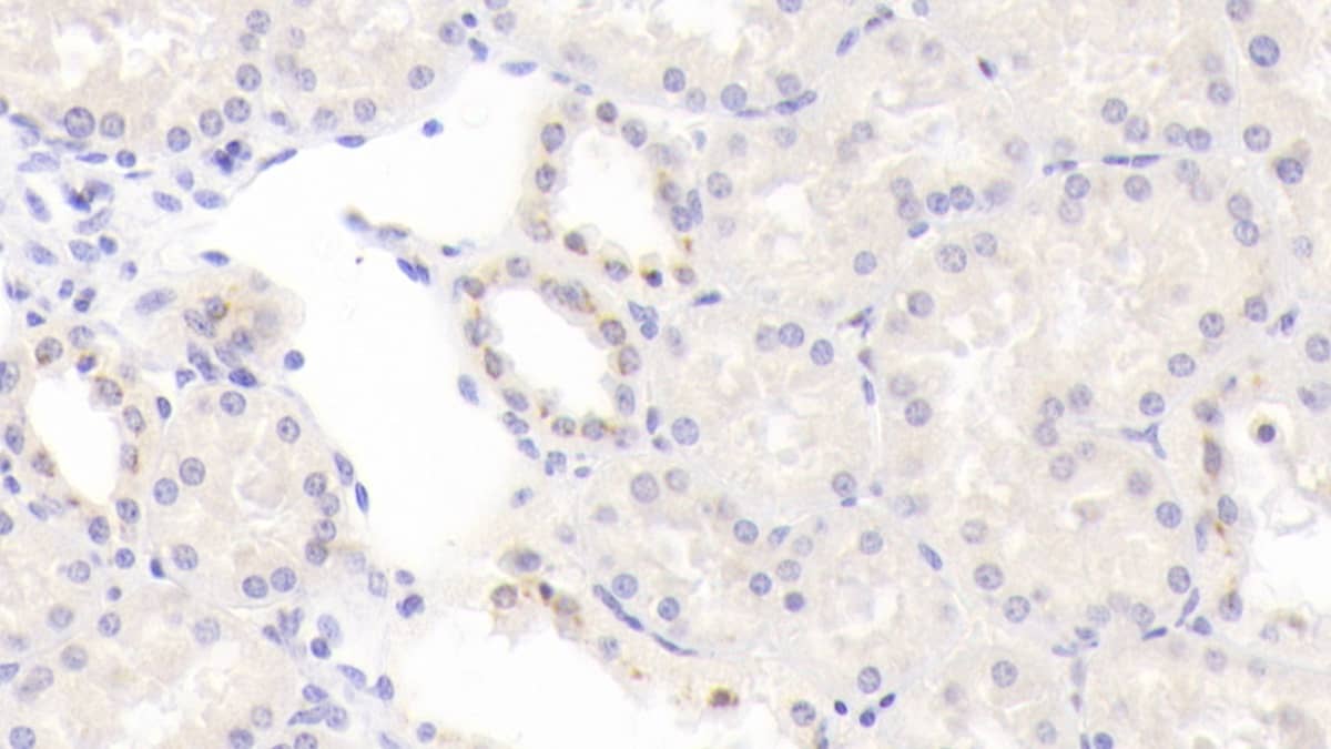 Immunohistochemistry-Paraffin: BMP-6 Antibody (D2) [NBP3-41154] - DAB staining on IHC-P; Samples: Human Kidney Tissue; Primary Ab: 20ug/ml NBP3-41154; Second Ab: 2ug/mL HRP-Linked Caprine Anti-Mouse IgG Polyclonal Antibody