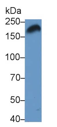 Western Blot: Pappalysin-1/PAPP-A Antibody (H4) [NBP3-41156] - Sample: Human Placenta lysate Primary Ab: 2ug/ml NBP3-41156; Second Ab: 0.2ug/mL HRP-Linked Caprine Anti-Mouse IgG Polyclonal Antibody