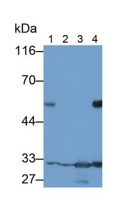 Western Blot: Podocin/NPHS2 Antibody (C3) [NBP3-41158] - Sample: Lane1: Human Serum; Lane2: Mouse Kidney lysate; Lane3: Rat Colon lysate; Lane4: Rat Kidney lysate Primary Ab: 2ug/ml NBP3-41158; Second Ab: 0.2ug/mL HRP-Linked Caprine Anti-Mouse IgG Polyclonal Antibody