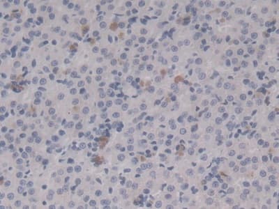 Immunohistochemistry-Paraffin: HSP20/HSPB6 Antibody (C5) [NBP3-41160] - DAB staining on IHC-P; Sample: Rat Adrenal gland Tissue; Primary Ab: 20ug/ml NBP3-41160; Second Ab: 2ug/mL HRP-Linked Caprine Anti-Mouse IgG Polyclonal Antibody