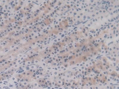 Immunohistochemistry-Paraffin: HSP20/HSPB6 Antibody (C5) [NBP3-41160] - DAB staining on IHC-P; Sample: Rat Stomach Tissue; Primary Ab: 20ug/ml NBP3-41160; Second Ab: 2ug/mL HRP-Linked Caprine Anti-Mouse IgG Polyclonal Antibody