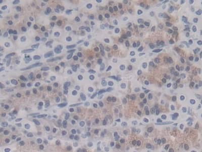 Immunohistochemistry-Paraffin: HSP20/HSPB6 Antibody (C10) [NBP3-41161] - DAB staining on IHC-P; Sample: Rat Stomach Tissue; Primary Ab: 20ug/ml NBP3-41161; Second Ab: 2ug/mL HRP-Linked Caprine Anti-Mouse IgG Polyclonal Antibody