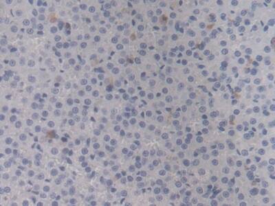 Immunohistochemistry-Paraffin: HSP20/HSPB6 Antibody (C10) [NBP3-41161] - DAB staining on IHC-P; Sample: Rat Adrenal gland Tissue; Primary Ab: 20ug/ml NBP3-41161; Second Ab: 2ug/mL HRP-Linked Caprine Anti-Mouse IgG Polyclonal Antibody