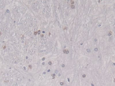 Immunohistochemistry-Paraffin: HSP20/HSPB6 Antibody (C10) [NBP3-41161] - DAB staining on IHC-P; Sample: Rat Spinal cord Tissue; Primary Ab: 20ug/ml NBP3-41161; Second Ab: 2ug/mL HRP-Linked Caprine Anti-Mouse IgG Polyclonal Antibody