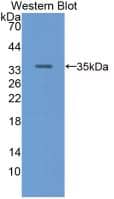 Western Blot RBP3 Antibody (7#)