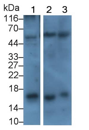 Western Blot: Corticotropin Releasing Factor Antibody (E1) [NBP3-41165] - Sample: Lane1: Human Placenta lysate; Lane2: Rat Cerebrum lysate; Lane3: Rat Pituitary lysate Primary Ab: 0.5ug/ml NBP3-41165; Second Ab: 0.2ug/mL HRP-Linked Caprine Anti-Mouse IgG Polyclonal Antibody