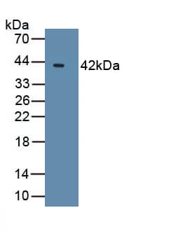 Western Blot: Bcl 7A Antibody [NBP3-41167] - Recombinant Human Bcl 7A