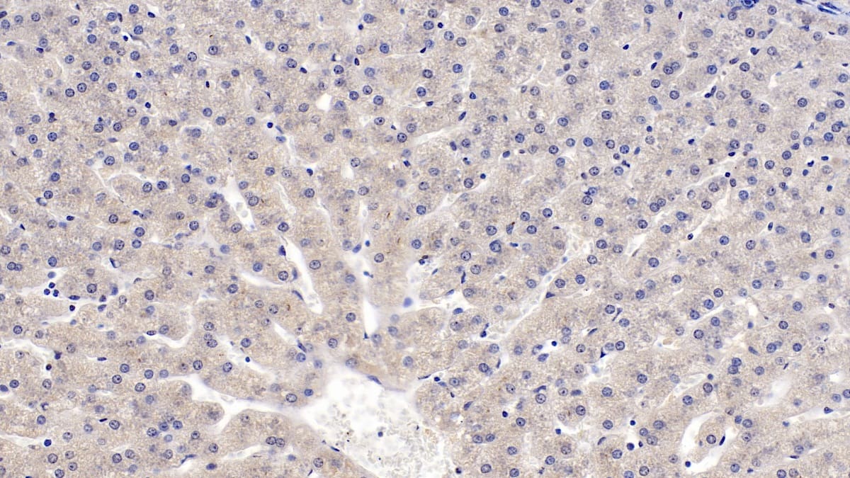 Immunohistochemistry-Paraffin: IGFBP-4 Antibody (C12) [NBP3-41169] - DAB staining on IHC-P; Sample: Human Liver Tissue; Primary Ab: 10ug/ml NBP3-41169; Second Ab: 2ug/mL HRP-Linked Caprine Anti-Mouse IgG Polyclonal Antibody