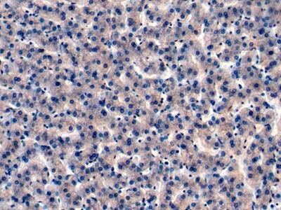 Immunohistochemistry-Paraffin: IGFBP-4 Antibody (C1) [NBP3-41170] - DAB staining on IHC-P; Samples: Human Liver Tissue; Primary Ab: 10ug/ml NBP3-41170; Second Ab: 2ug/mL HRP-Linked Caprine Anti-Mouse IgG Polyclonal Antibody