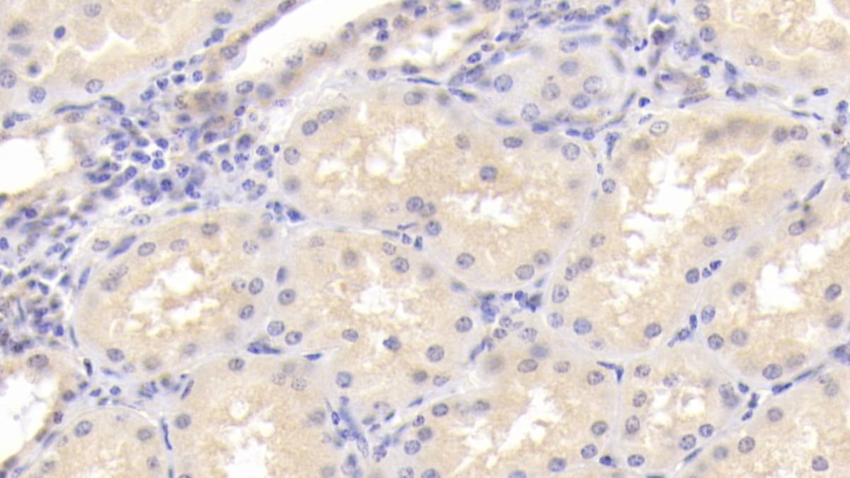 Immunohistochemistry-Paraffin: Osteoprotegerin/TNFRSF11B Antibody (C1) [NBP3-41173] - DAB staining on IHC-P; Sample: Human Kidney Tissue; Primary Ab: 20ug/ml NBP3-41173; Second Ab: 2ug/mL HRP-Linked Caprine Anti-Mouse IgG Polyclonal Antibody