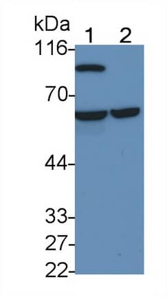 Western Blot: t-Plasminogen Activator/tPA Antibody (L3) [NBP3-41176] - Sample: Lane1: Human Serum; Lane2: Human Plasma Primary Ab: 0.1ug/ml NBP3-41176; Second Ab: 0.2ug/mL HRP-Linked Caprine Anti-Mouse IgG Polyclonal Antibody