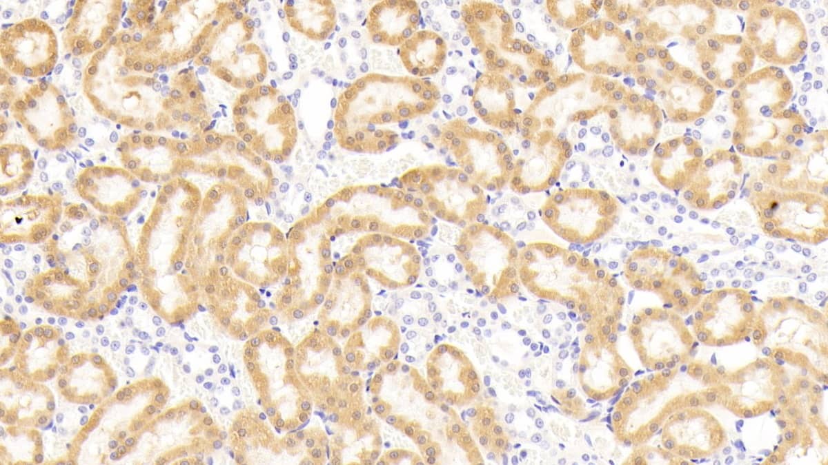 Immunohistochemistry-Paraffin: NOX3 Antibody [NBP3-41179] - DAB staining on fromalin fixed paraffin-embedded Kidney tissue