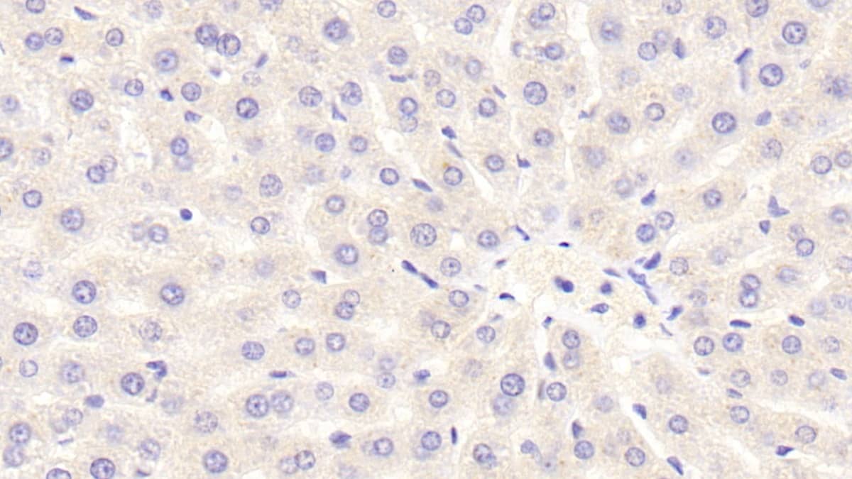 Immunohistochemistry-Paraffin: NOX3 Antibody [NBP3-41179] - DAB staining on IHC-P; Samples: Rat Liver Tissue; Primary Ab: 10ug/ml NBP3-41179; Second Ab: 2ug/mL HRP-Linked Caprine Anti-Rabbit IgG Polyclonal Antibody