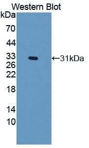Western Blot: NOX3 Antibody [NBP3-41179] - Sample: Recombinant protein.