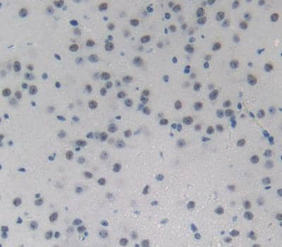 Immunohistochemistry-Paraffin: NUP214 Antibody [NBP3-41180] - Used in DAB staining on fromalin fixed paraffin- embedded Kidney tissue