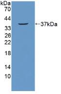 Western Blot NUP214 Antibody