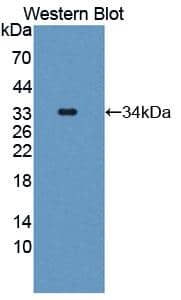 Western Blot: Latrophilin 2/LPHN2 Antibody [NBP3-41181] - Sample: Recombinant protein.