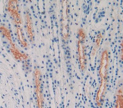 Immunohistochemistry-Paraffin: Latrophilin 2/LPHN2 Antibody [NBP3-41181] - Used in DAB staining on fromalin fixed paraffin- embedded Kidney tissue