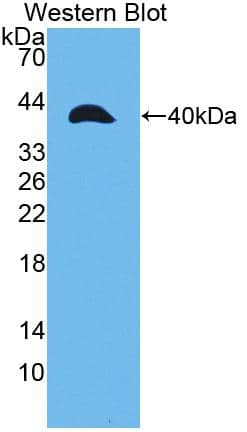 Western Blot: MMP23B Antibody [NBP3-41184] - Sample: Recombinant protein.