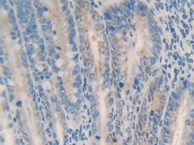 Immunohistochemistry-Paraffin: MMP23B Antibody [NBP3-41184] - DAB staining on IHC-P; Samples: Rat Intestine Tissue; Primary Ab: 10ug/ml NBP3-41184; Second Ab: 2ug/mL HRP-Linked Caprine Anti-Rabbit IgG Polyclonal Antibody