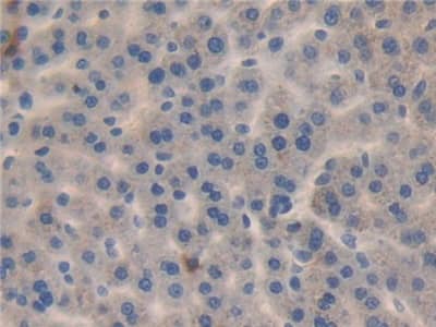 Immunohistochemistry-Paraffin: MMP23B Antibody [NBP3-41184] - DAB staining on fromalin fixed paraffin-embedded kidney tissue