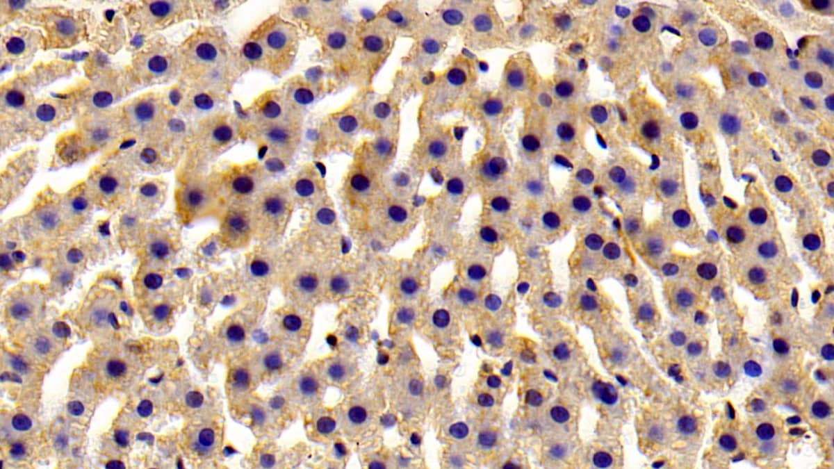 Immunohistochemistry-Paraffin ART4 Antibody